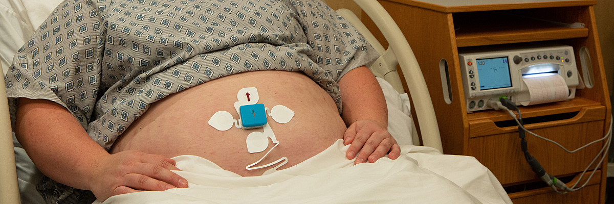 Obese woman attached to external fetal monitor