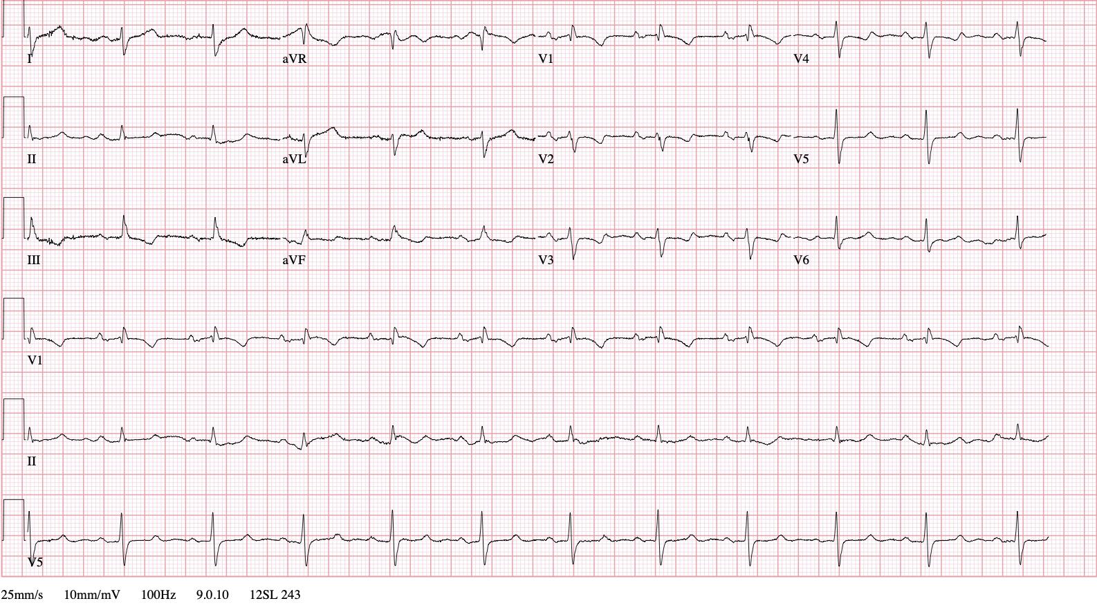 covid-ecg-reading.jpg