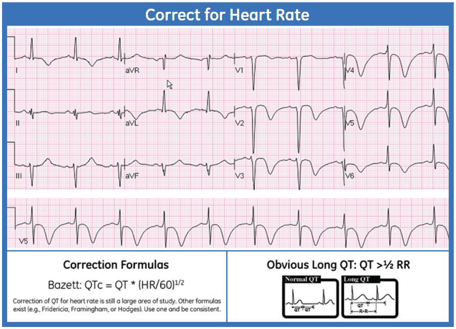 Correct for Heart Rate