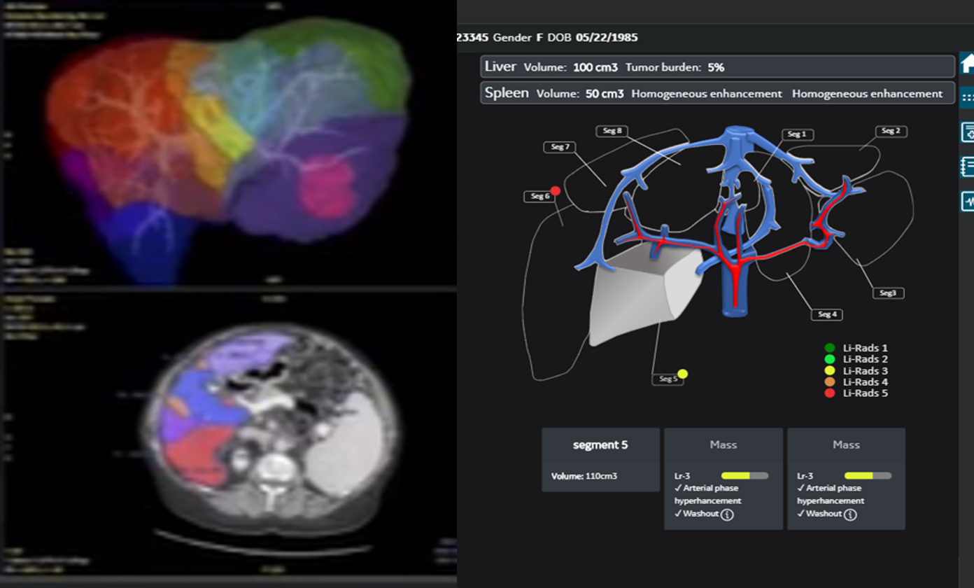 Application pour le diagnostic du cancer du foie.png