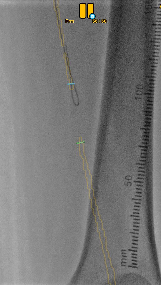 Fig 3.JPG