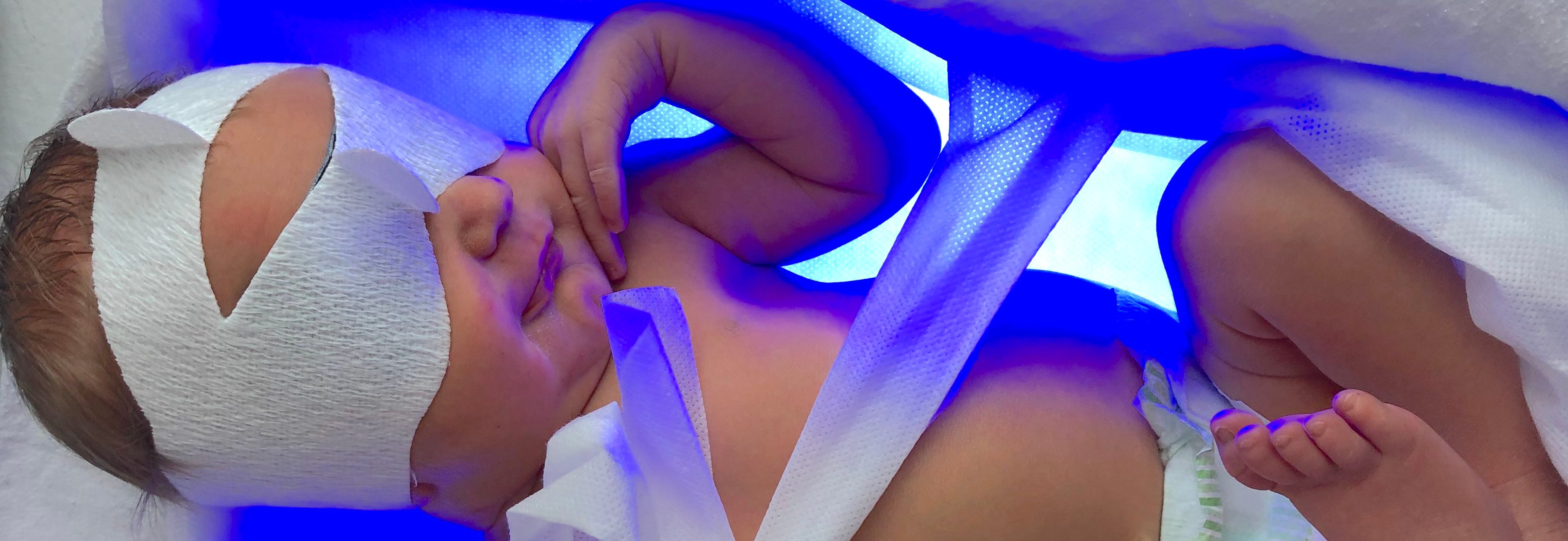 Sinivalohoito kotona helpottaa vauvaperheen arkea | GE HealthCare (Finland)