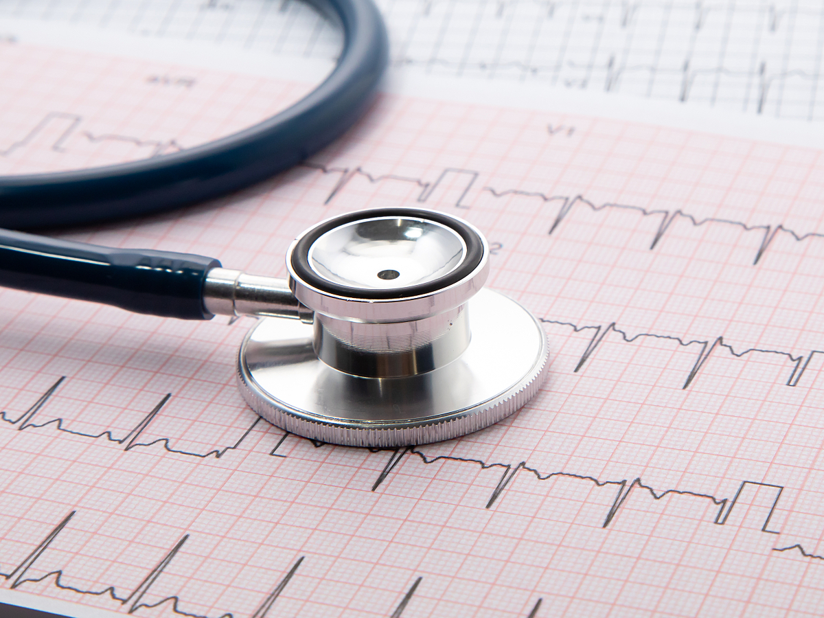 An ECG printout with a stethoscope lying on top. 