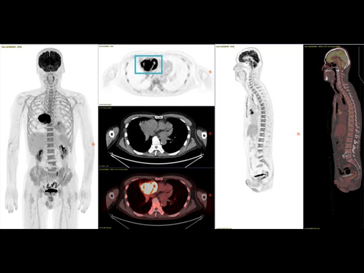 clinical image molecular imaging high image quality 