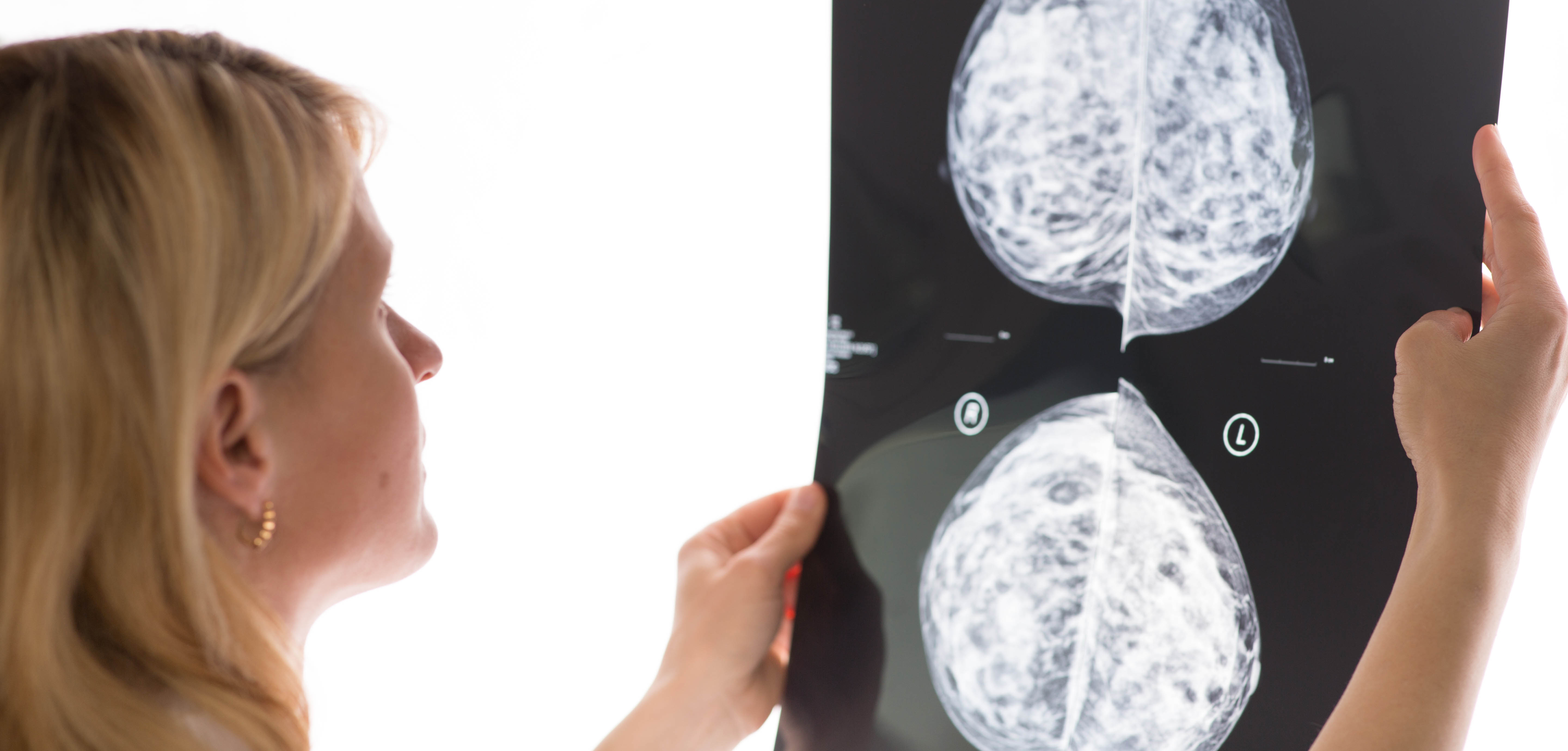 female doctor examining a mammogram result on medical monitor