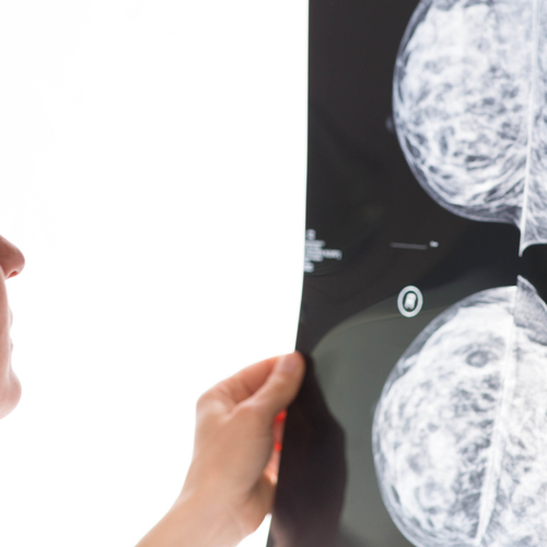 female doctor examining a mammogram result on medical monitor