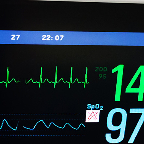 A neonatal heart rate monitor