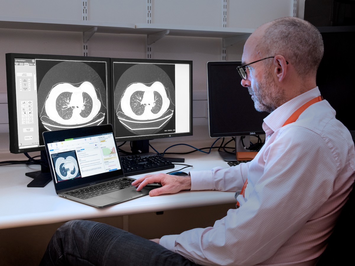 Come l’intelligenza artificiale può aiutare a identificare il cancro più letale al mondo.