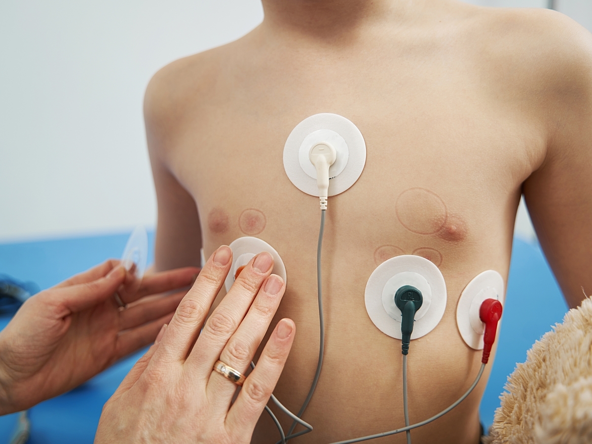 A child gets a Holter ECG to check for an arrhythmia. 