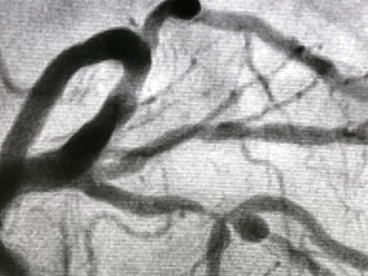 These basic noninvasive tools should always appropriately guide our hand toward or away from more invasive procedures, such as angiograms, which can carry substantial risk.