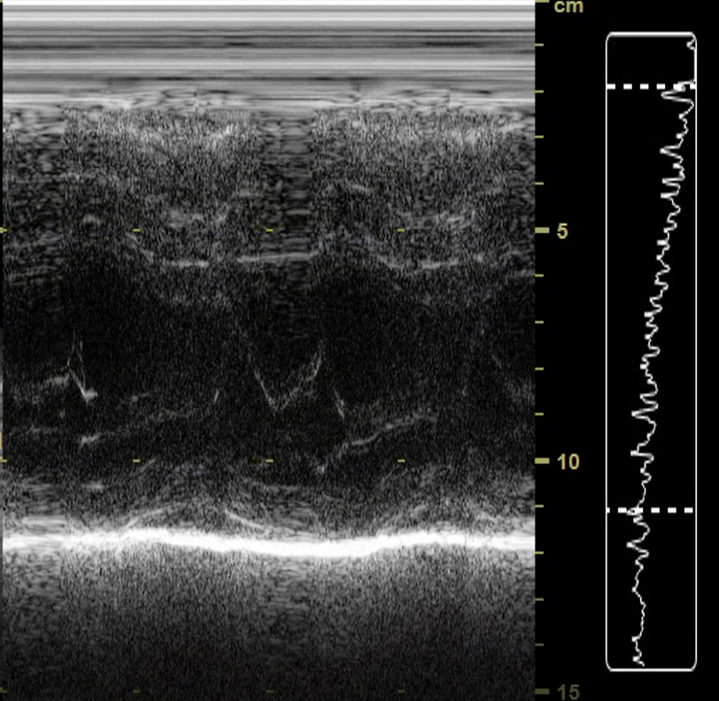 Always Evolving: The Future of Ultrasound is Exponential | GE ...