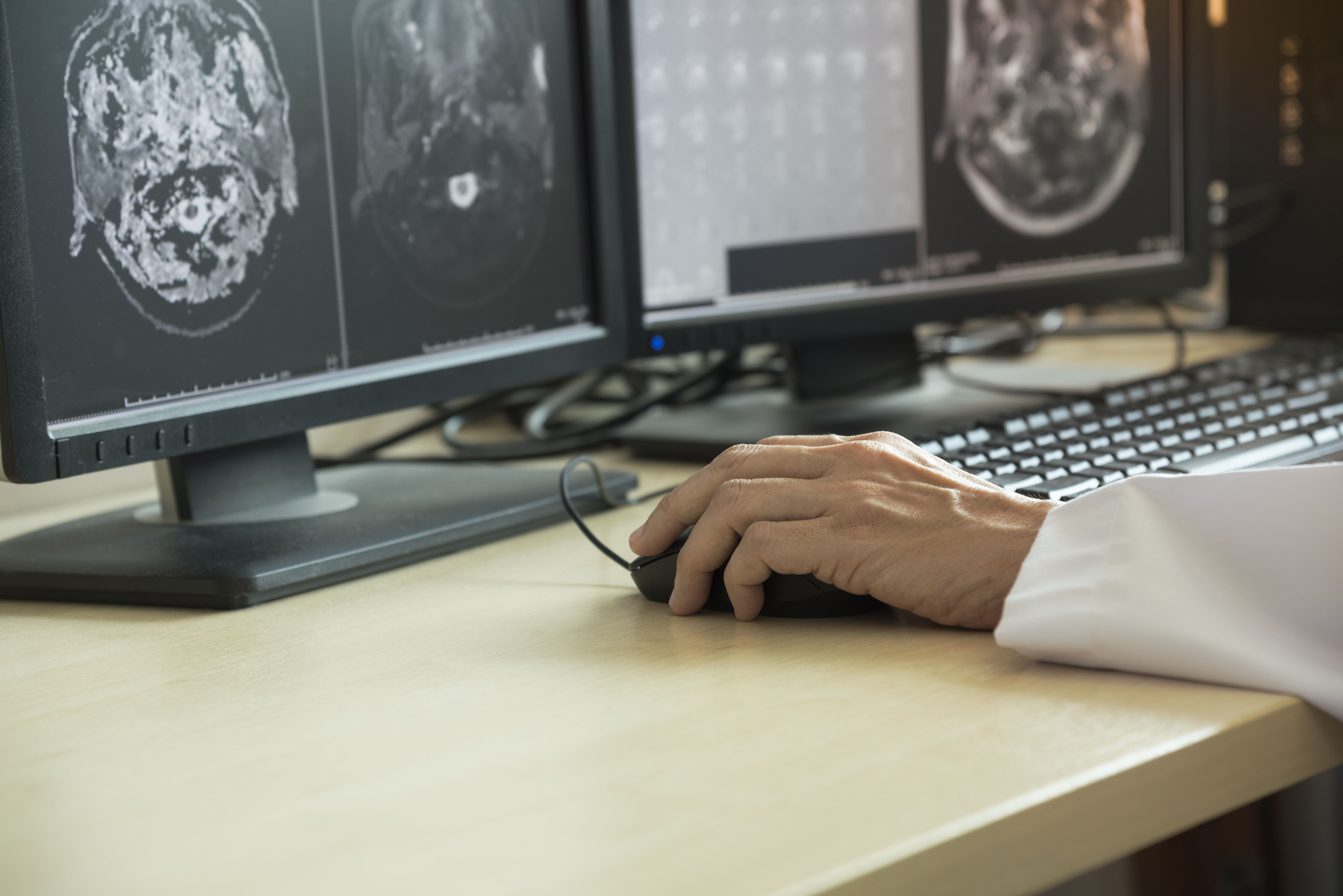 Doctor using computer to analyzing brain MRI in radiology room of the hospital