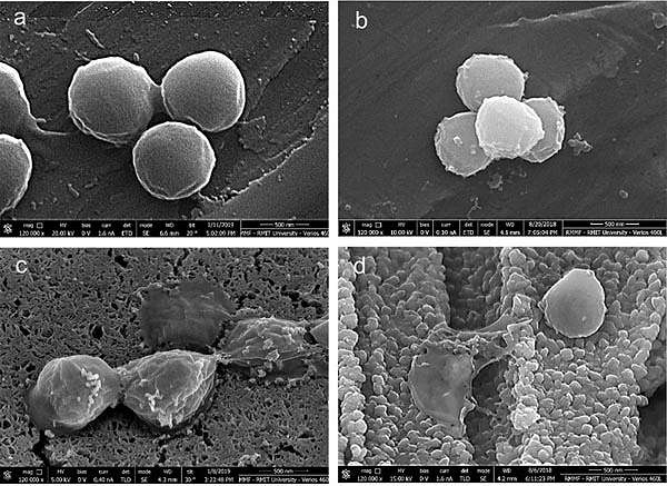 copper-surface-eliminates-bacteria-hg_re.jpg