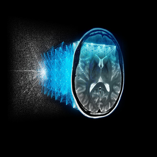 AIR Recon DL brain image graphic