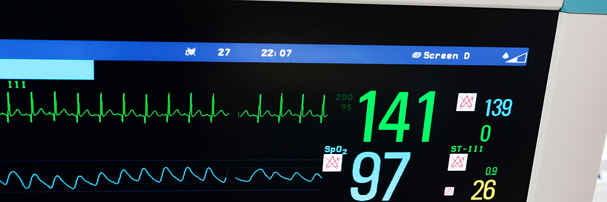 neonatal heart rate