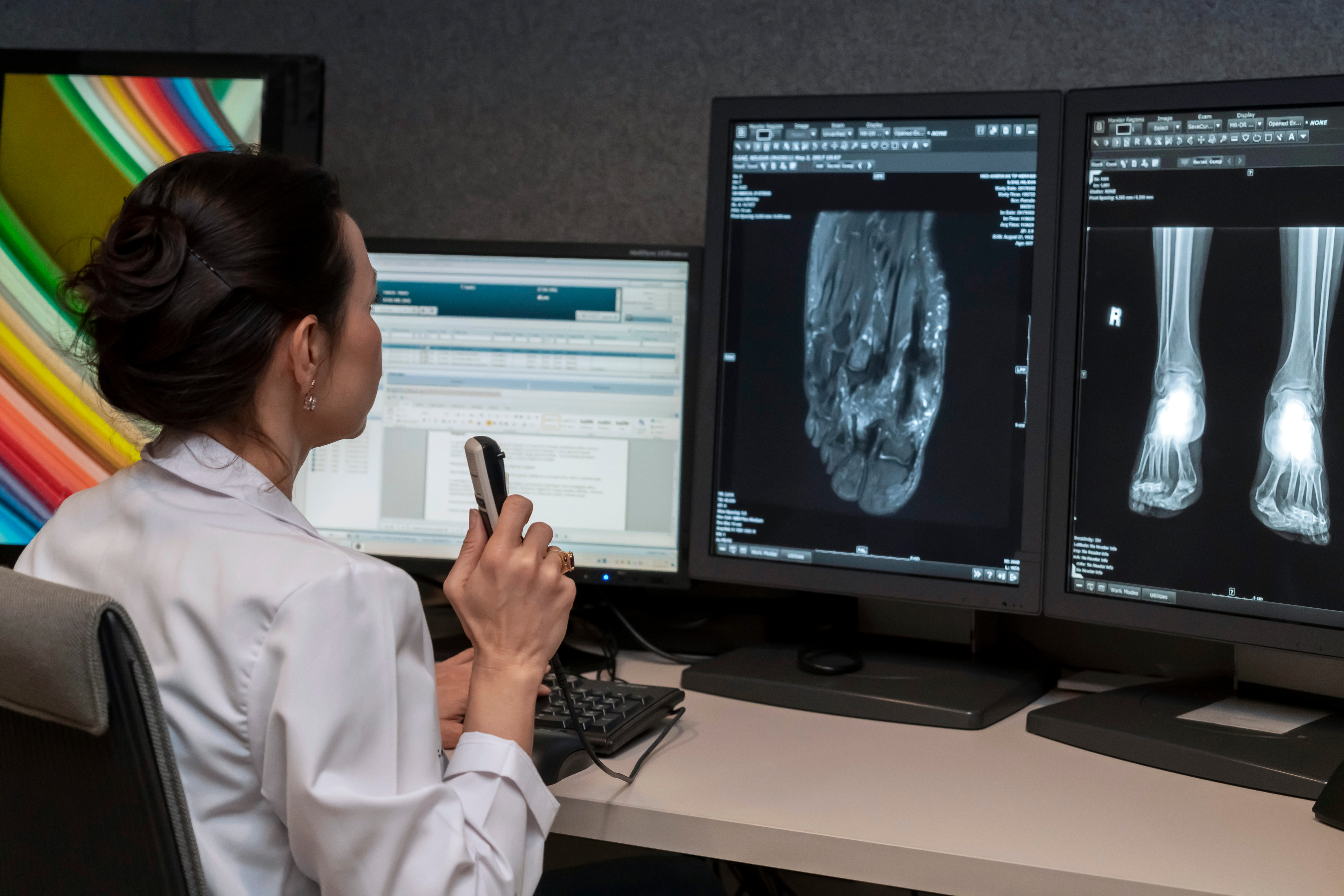 Migliorare l’accuratezza delle immagini e dei referti di radiologia grazie all'Intelligenza Artificiale
