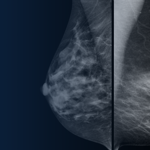 Clinical image of the breast