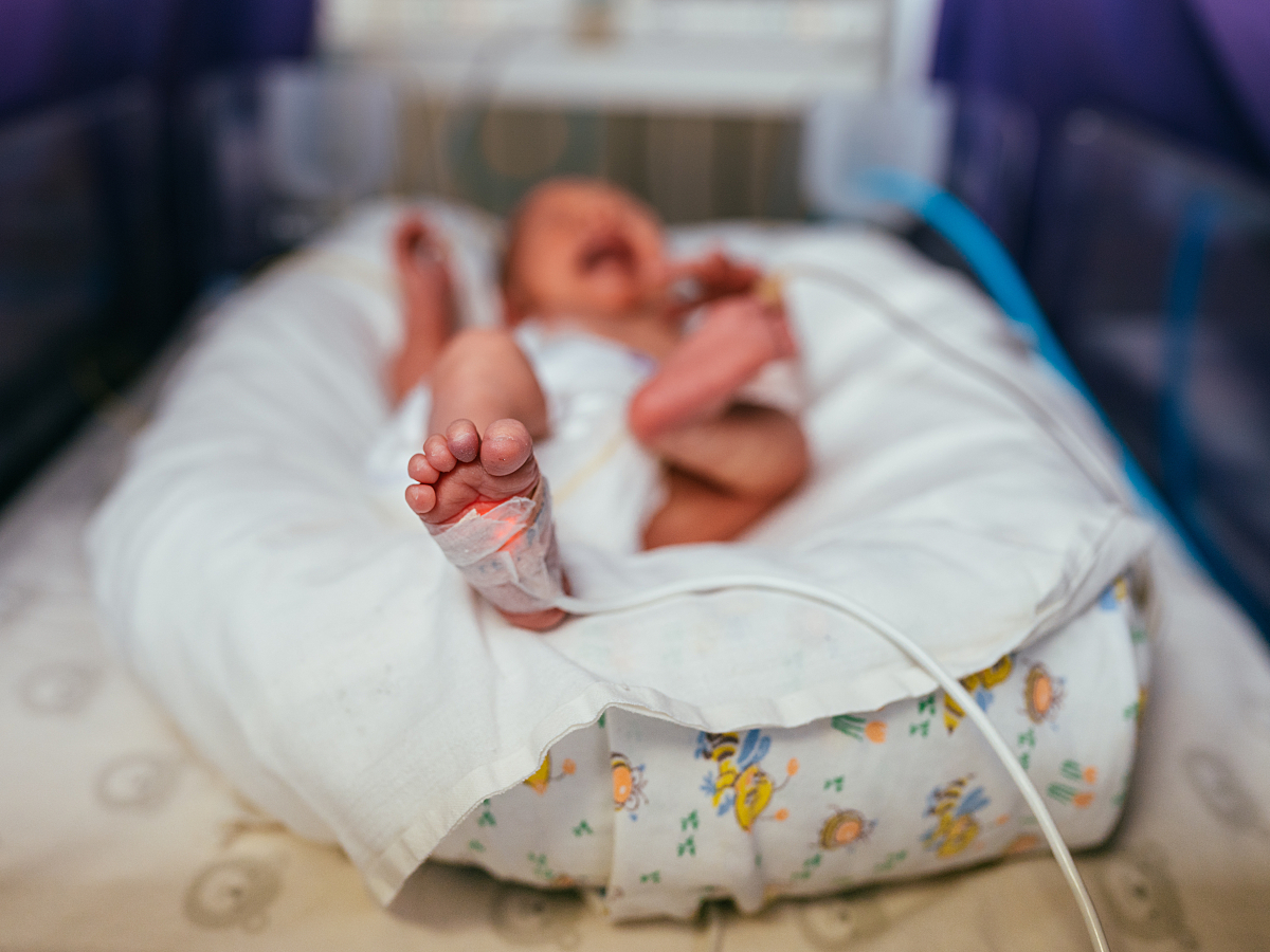 A newborn baby rests in a warmer in the NICU for thermoregulation