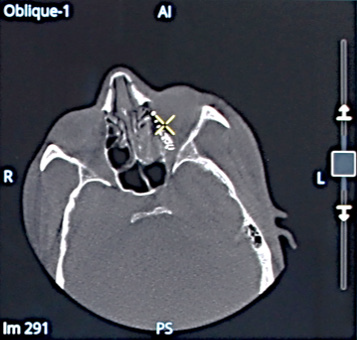 OEC 3D st. olav picture 9.png