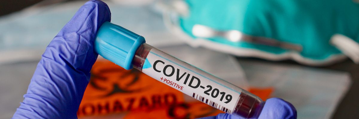 COVID-2019, the name chosen by WHO for the new rapidly spreading Coronavirus outbreak that originated in Wuhan, China