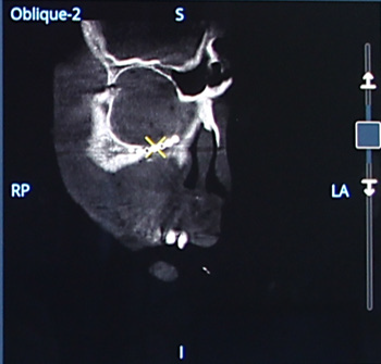 OEC 3D st. olav picture 20.png