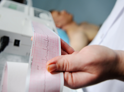 A cardiologist reviews an ECG printed on grid paper. 