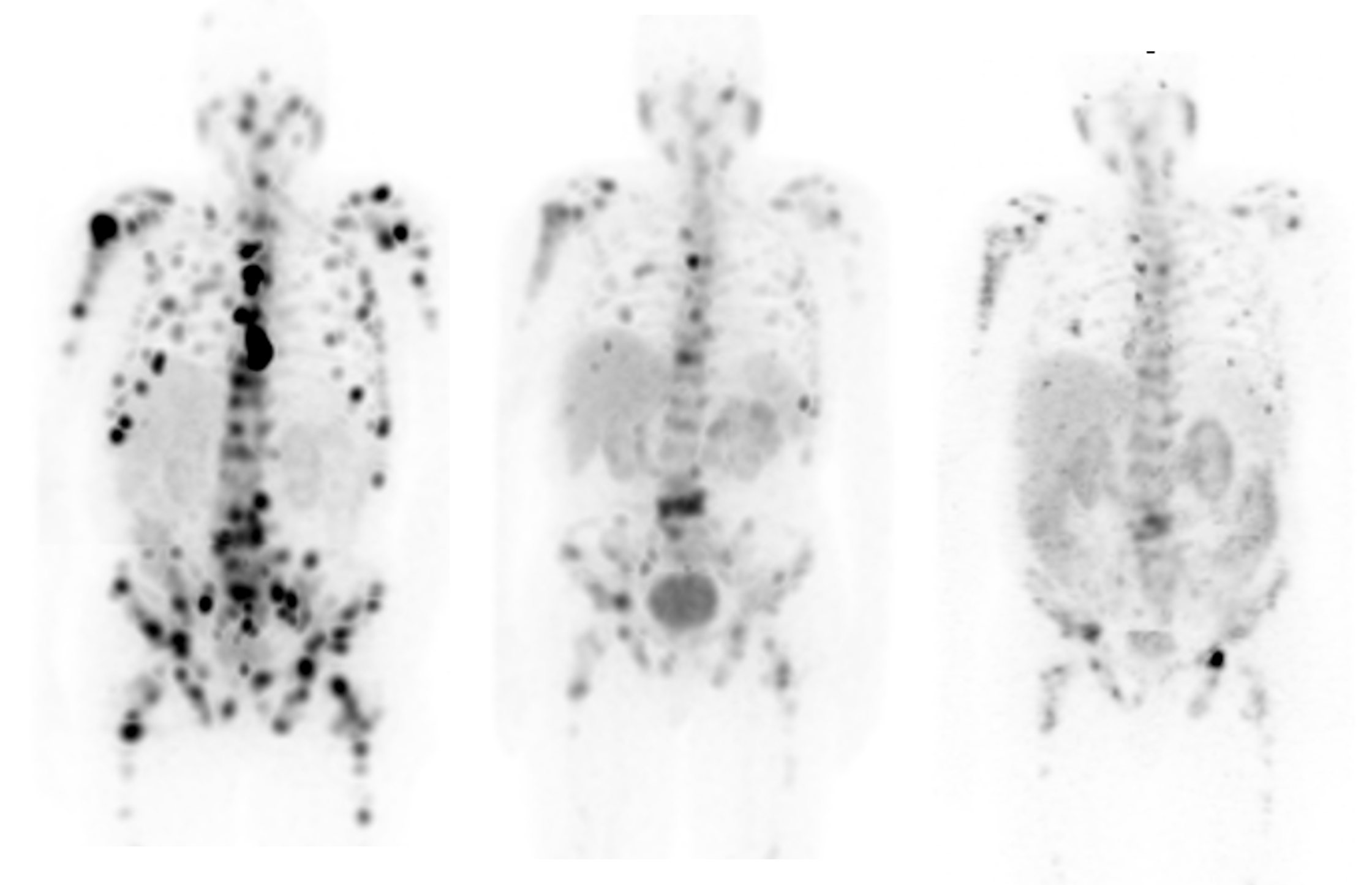 GE HealthCare e le soluzioni per la medicina di precisione al meeting annuale della SNMMI 2023