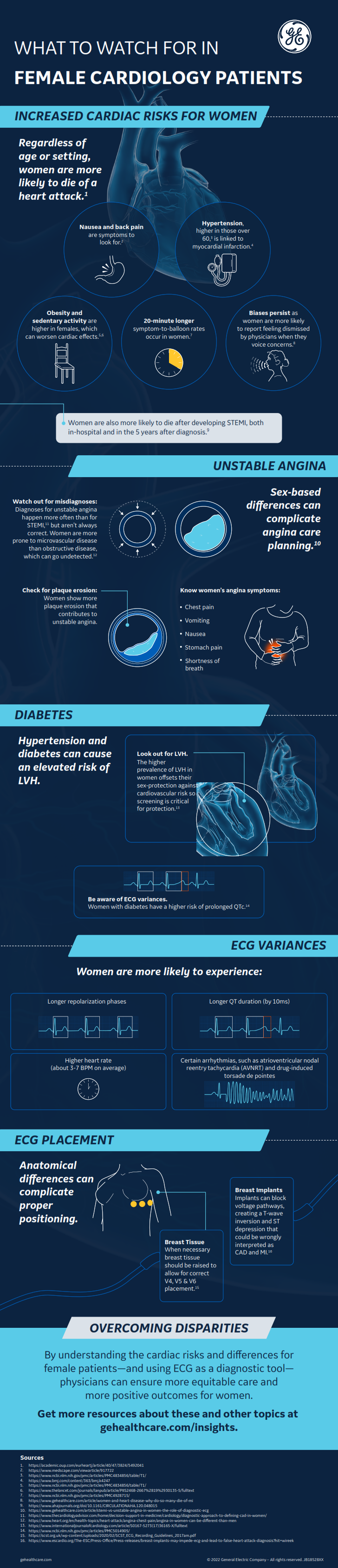 What to watch for in female cardiology patients - Infographic