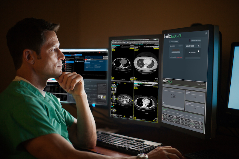 EDS True PACS_intelligent workload_with UV_and_Balance (2).jpg