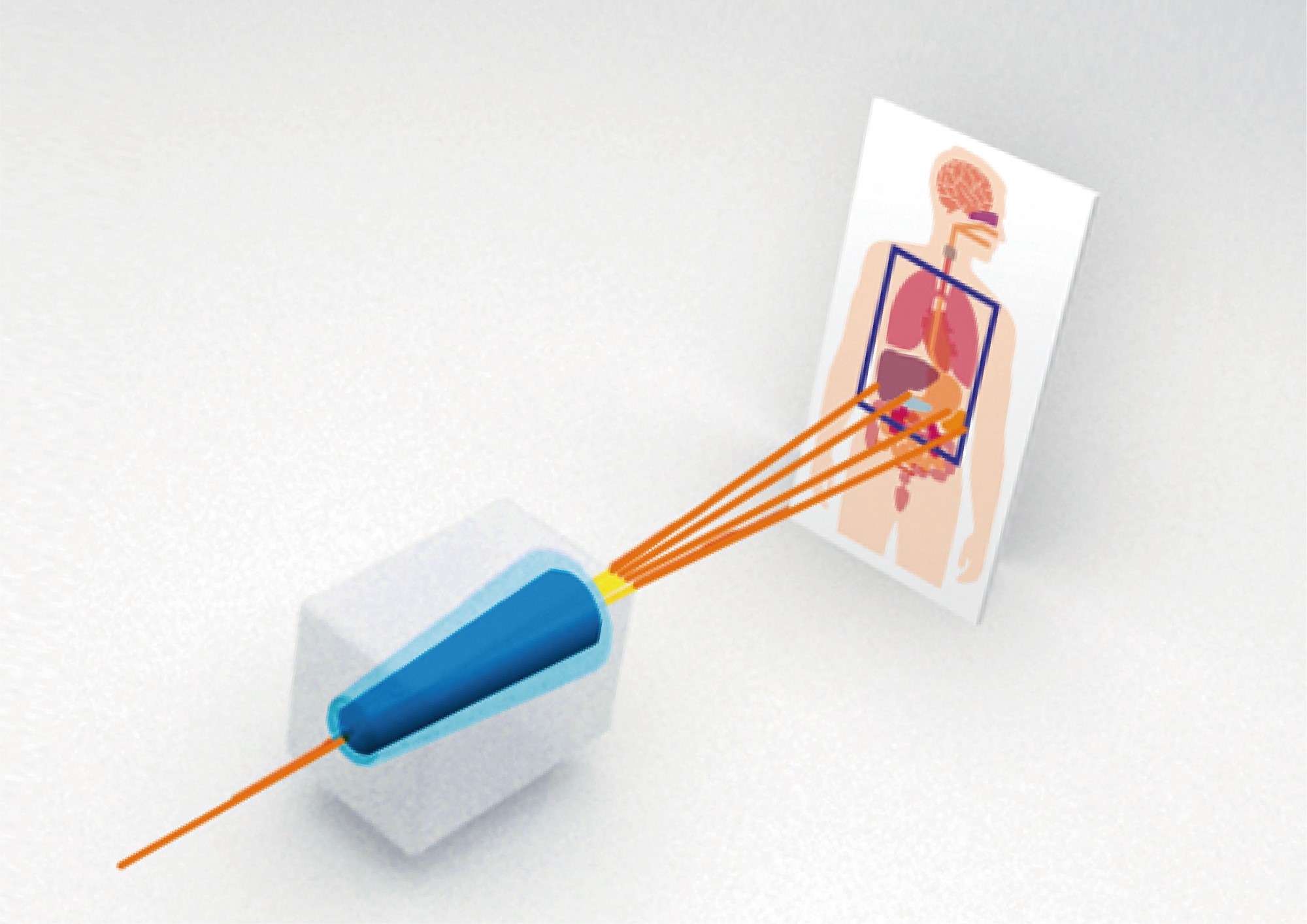 Heavy ions using carbon ions to pinpoint irradiation to cancer lesions with a pencil-shaped beam