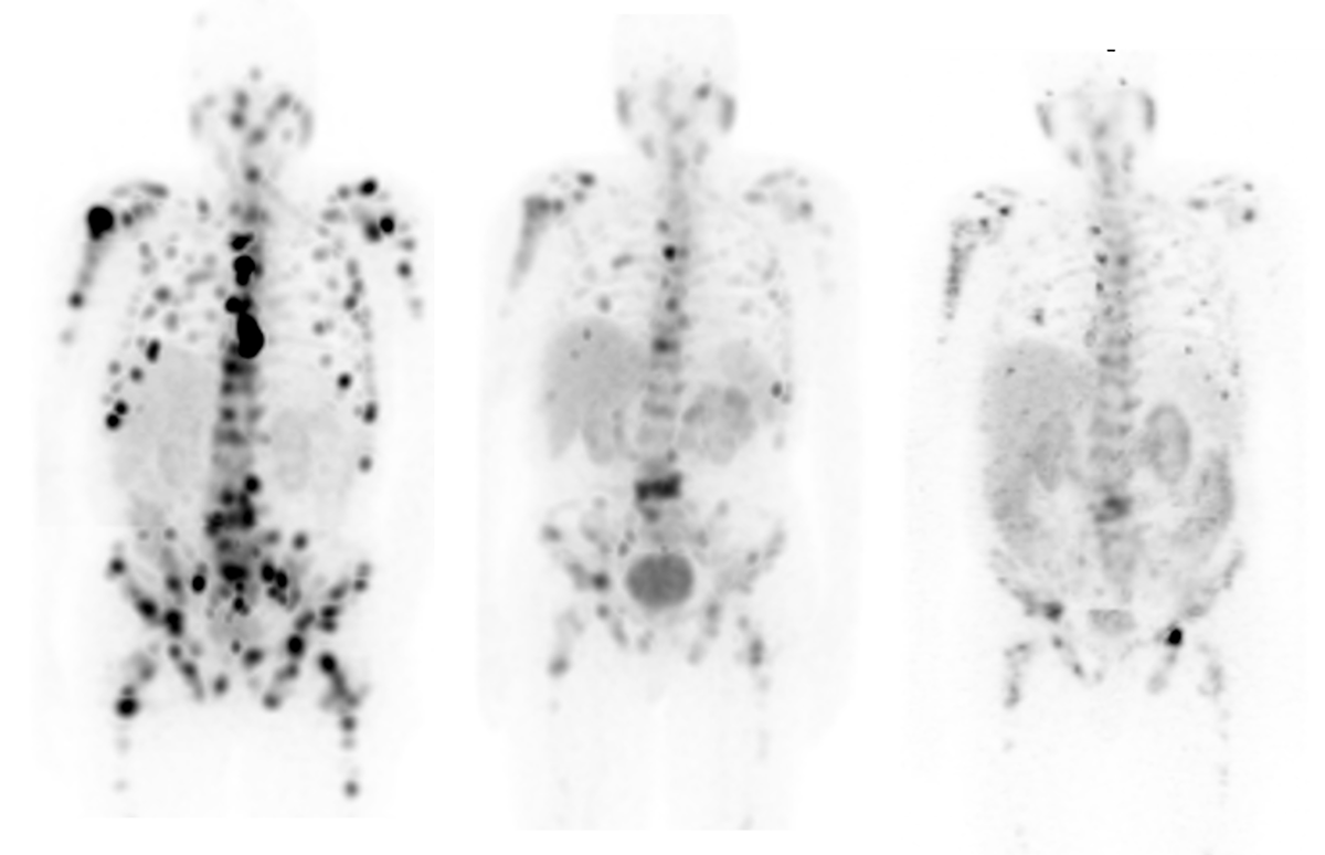 theranostics clinical_1200.png