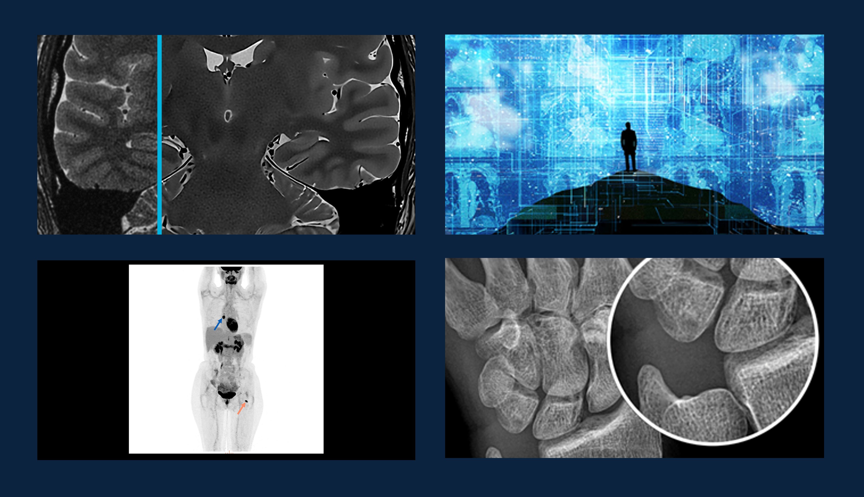 clinical images spanning MRI, CT, MI and X-ray using deep-learning imaging reconstruction or processing 