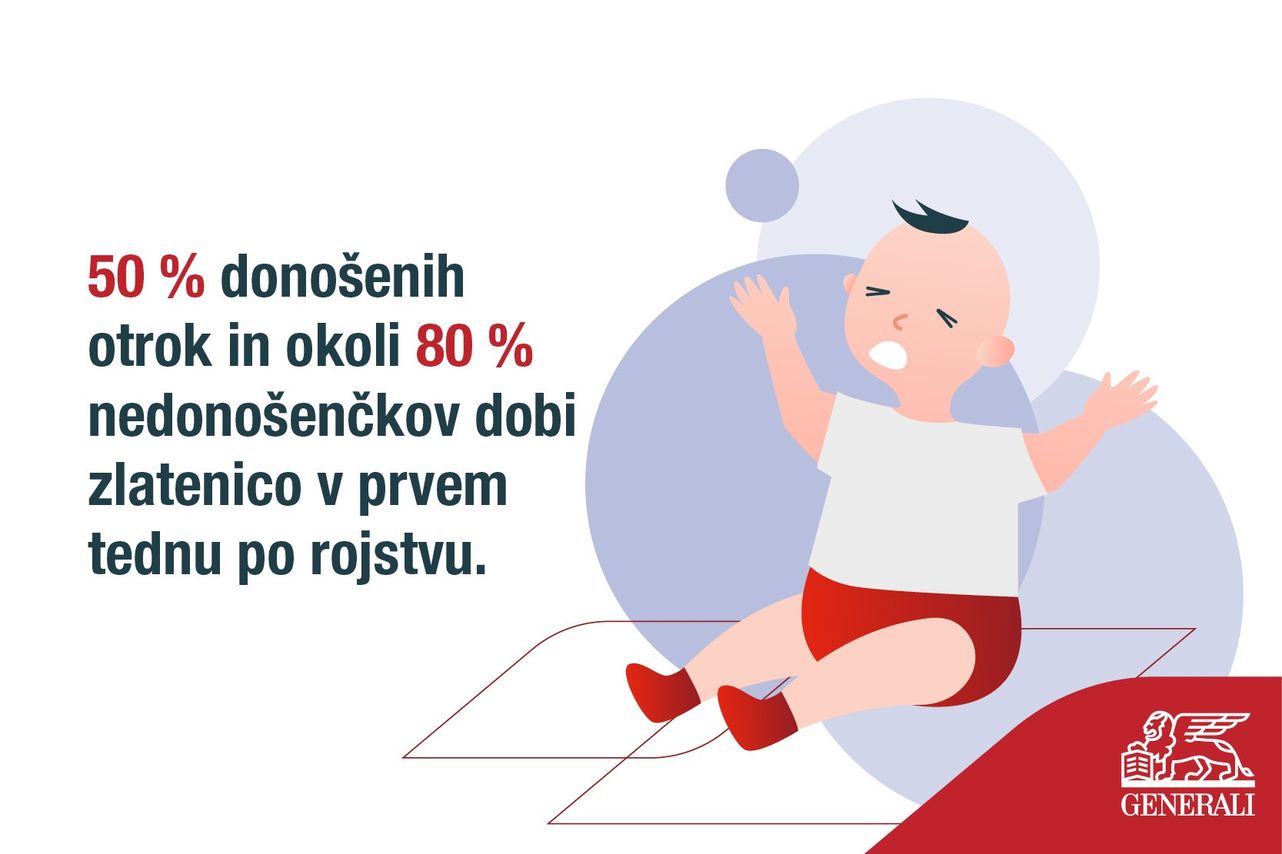 50 % donošenih otrok in okoli 80 % nedonošenčkov dobi zlatenco v prvem tednu po rojstvu.