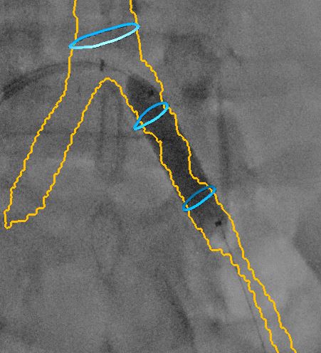 Fig 6.JPG